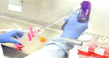 Azərbaycanda daha 4078 koronavirus testi həyata keçirilib