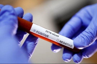 Daha 323 nəfərdə koronavirus aşkarlandı - 5 nəfər vəfat etdi, 228 nəfər sağaldı