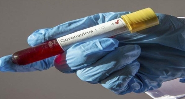 Uçuş həyata keçirəcək şəxsin koronavirus testi ödənişsiz aparılacaq