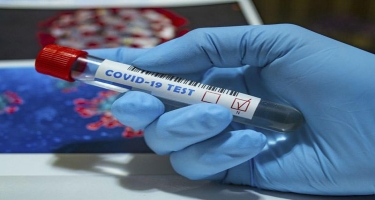 Azərbaycanda indiyədək koronavirusa yoluxma hallarını müəyyənləşdirmək üçün 381846 test aparılıb