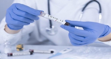 Bakıda təcili yardım evlərdə koronavirus testi götürülməsini dayandırıb? – “Poliklinikaya gedin”