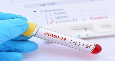 Koronavirusu simptomsuz keçirməyi necə müəyyənləşdirmək olar? - AÇIQLAMA