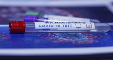 Ədliyyə Nazirliyi: İşçilər və məhkumlardan 13 minədək test götürülüb, 18 nəfərdə virus aşkarlanıb