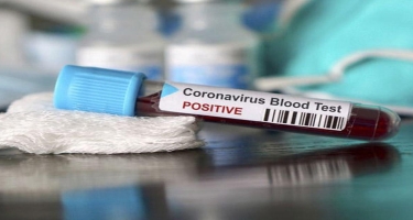 Koronavirusa yoluxan Mais Ağayev sağaldı - Sonuncu testin nəticələri NEQATİV çıxdı
