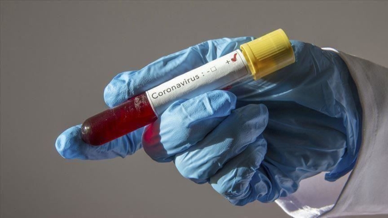 ÜST: Dünyada koronavirusa yoluxanların sayı 688 mindən çox artıb