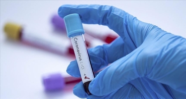 Agentlik: 25 və 26 iyul koronavirus testinin nəticələri haqqında göndərilən məlumatda yanlışlıq olub