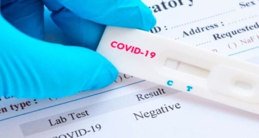 Komitə sədri: COVİD-19-a görə testlərin aparılmasında səmərəlilik effekti olmalıdır