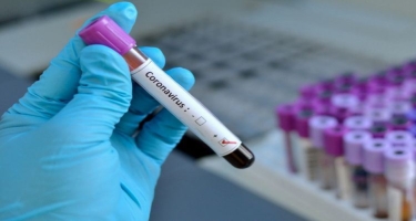 Filippin Rusiyanın istehsal etdiyi koronavirus vaksinini sınaqdan keçirməyi planlaşdırır