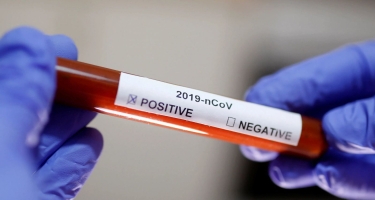 İngiltərə Premyer Liqasında daha 8 nəfər koronavirusa yoluxub