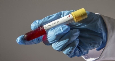 ÜST: Dünyada ötən sutka koronavirusa 376 mindən çox yoluxma qeydə alınıb