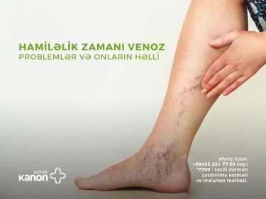 Hamiləlik zamanı venoz problemlər və onların həlli (FOTO)