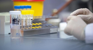 Cənubi Koreyada koronavirus testlərinin təhlükəsiz keçirilməsi üçün kapsullar hazırlanıb
