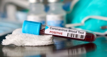 Dünyada koronavirusa yoluxanların sayı 2 milyonu keçdi