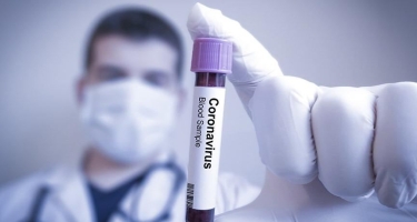 Dünyada koronavirusa yoluxanların sayı 10 milyonu keçdi